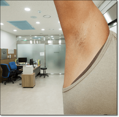 겨드랑이 멍울 부기