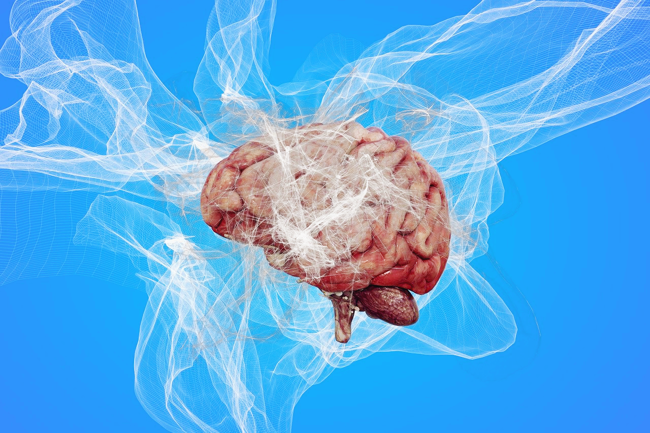 치매 검사 방법