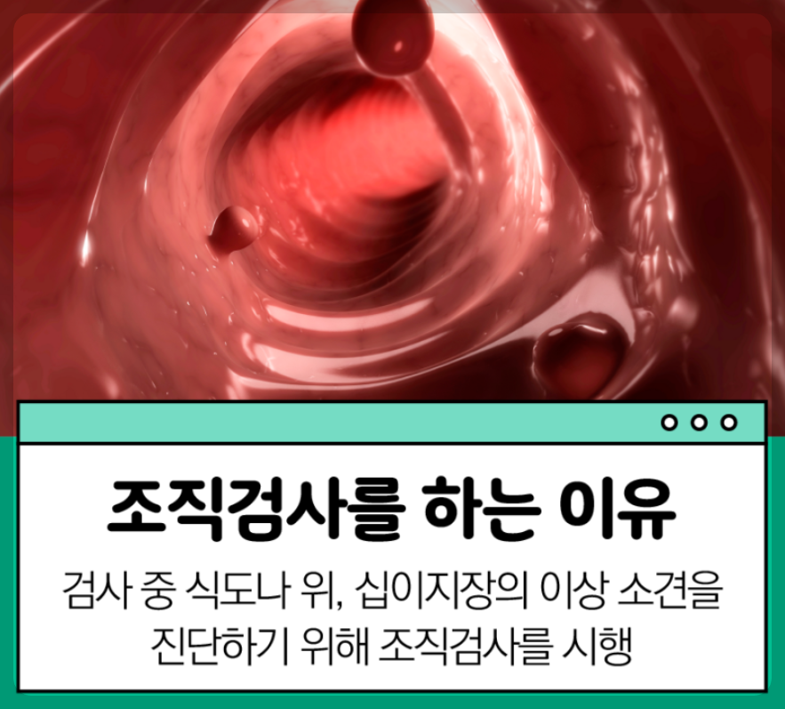 위내시경 조직검사 하는 이유