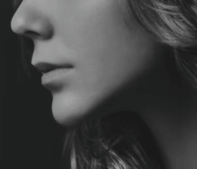 블랙헤드 없애는 방법 - 유전