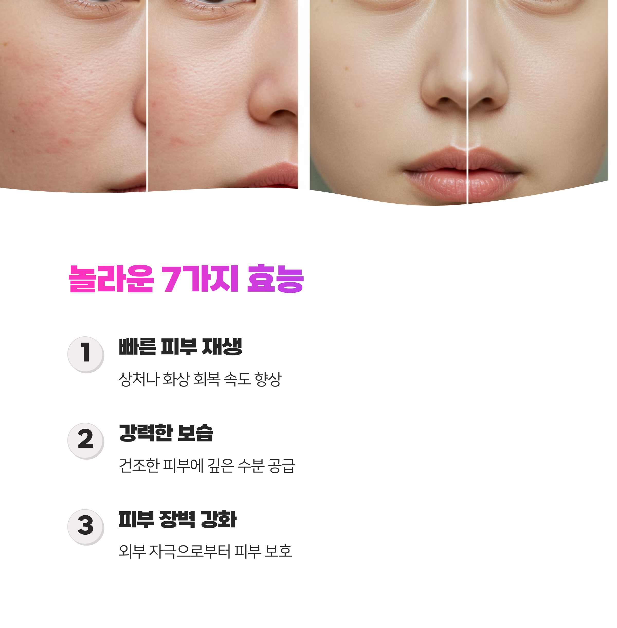 비판텐 연고&amp;#44; 지성&amp;#44; 건성 어떤 피부를 구원한다고?