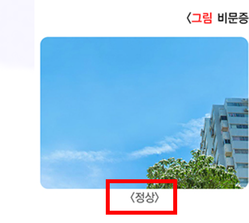 비문증 치료방법 알아보기