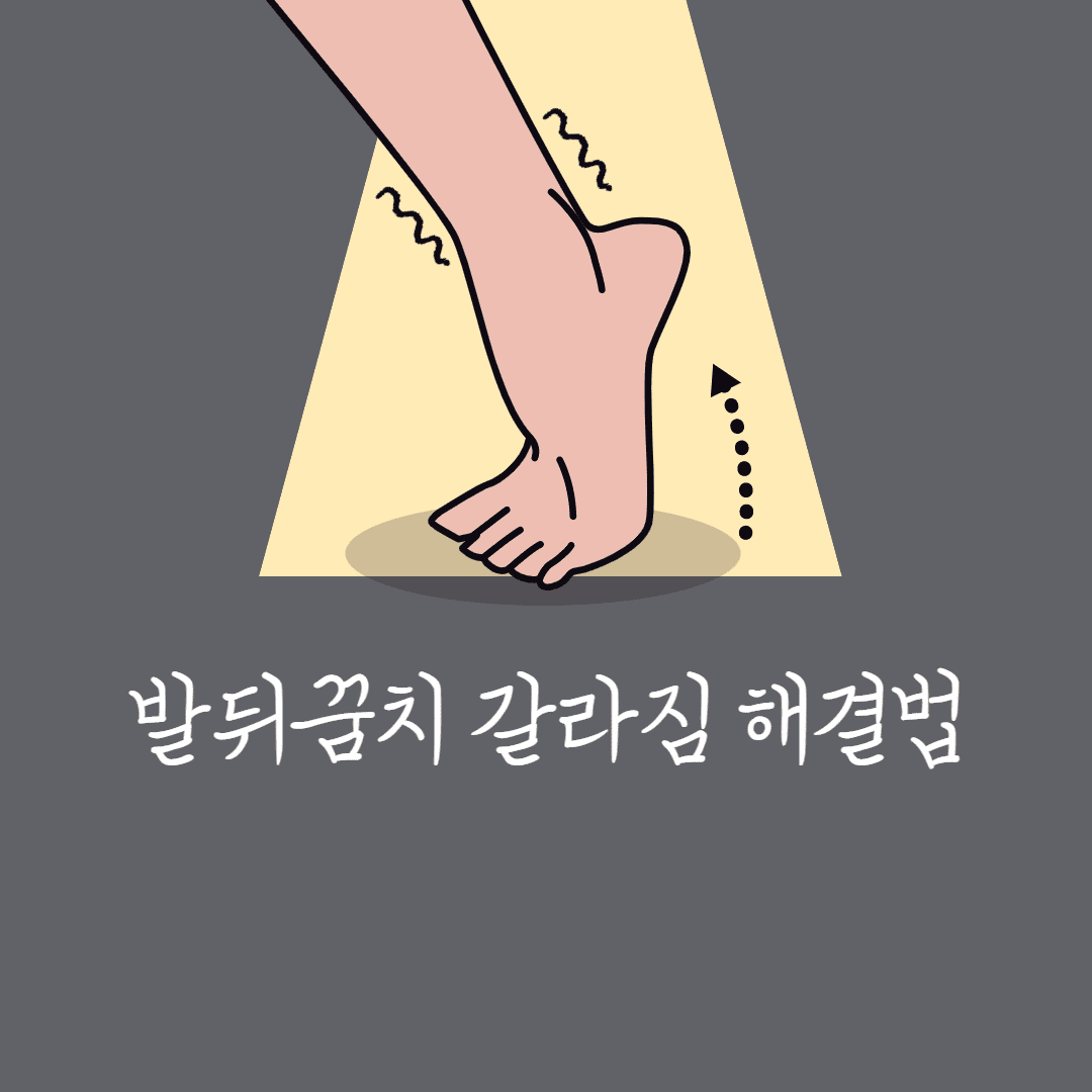 발뒤꿈치 갈라짐 해결법
