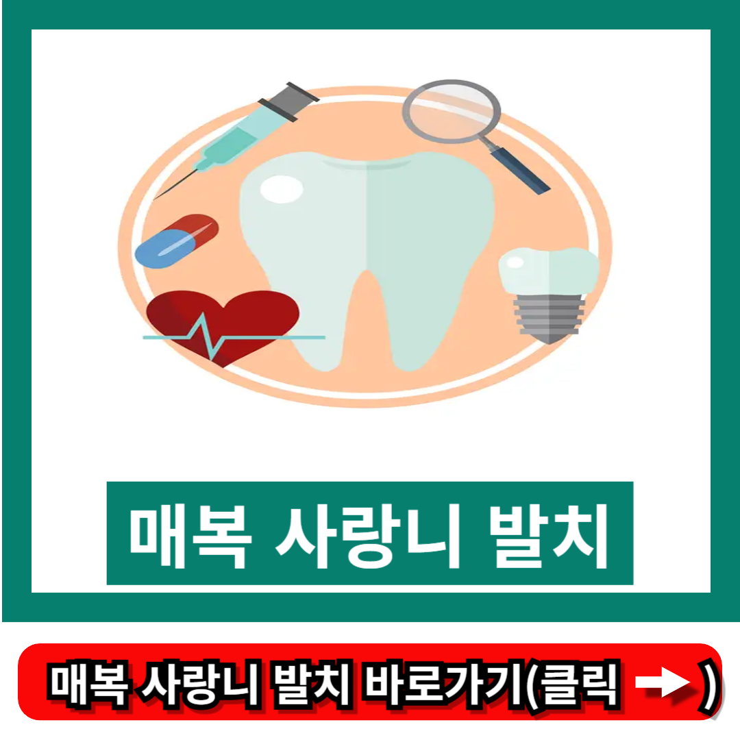 매복 사랑니 발치