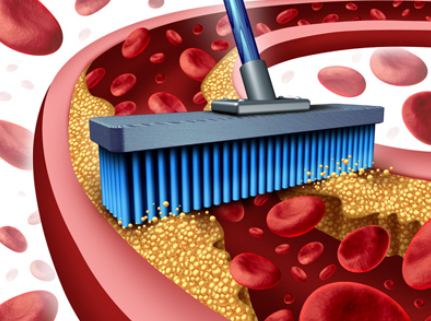 혈액순환에 장애가 생기면