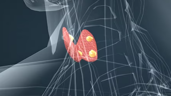 갑상선 기능 저하증의 증상