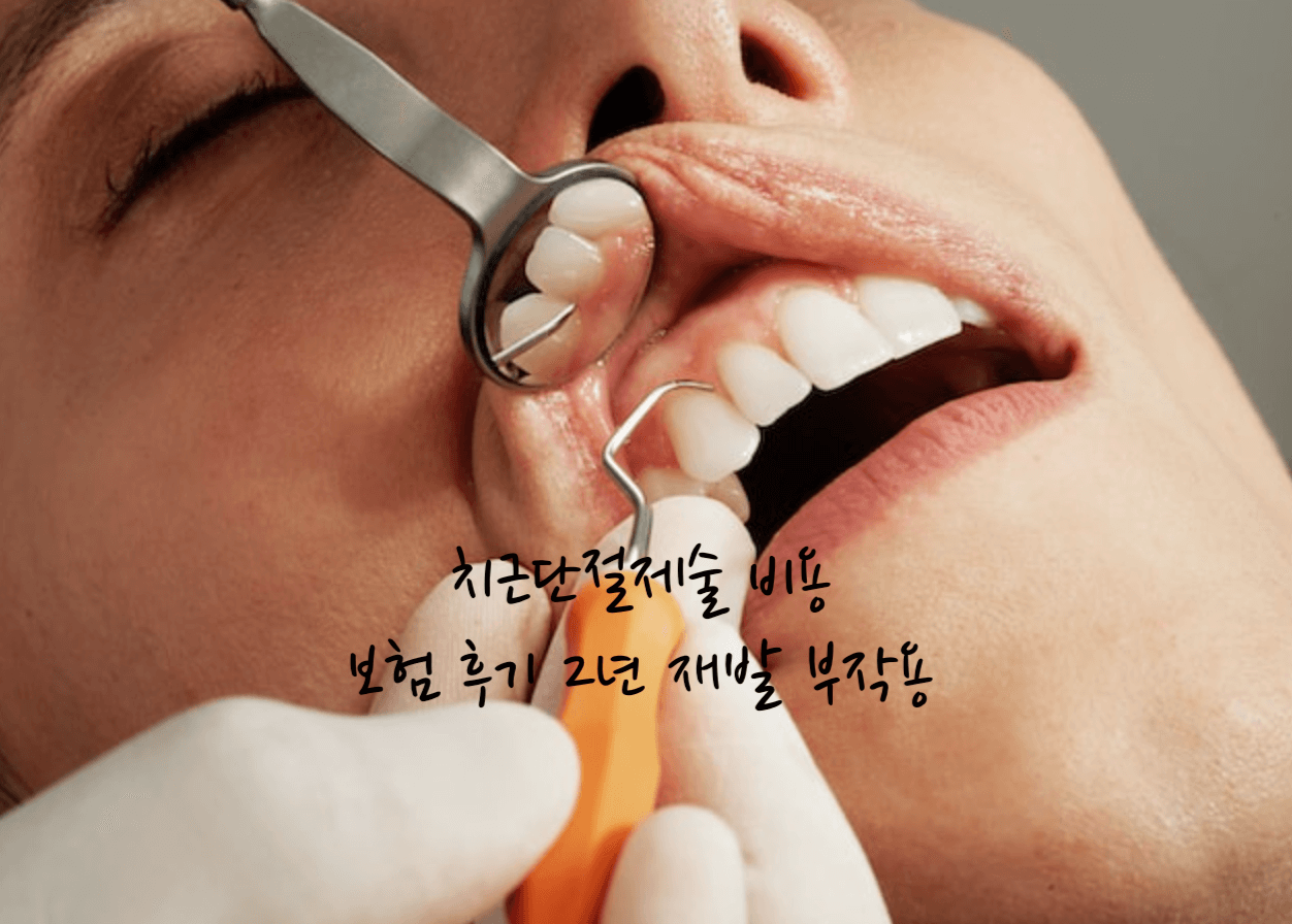 치근단절제술