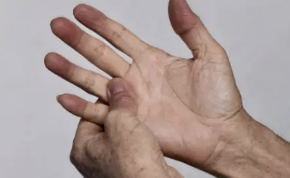 심근경색 초기증상 24