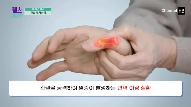 일본무릎관절염약