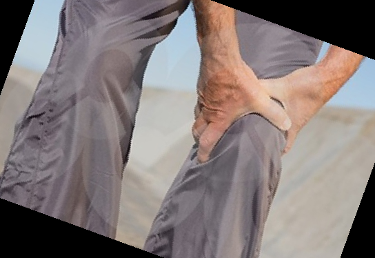 콘쥬란 주사 가격