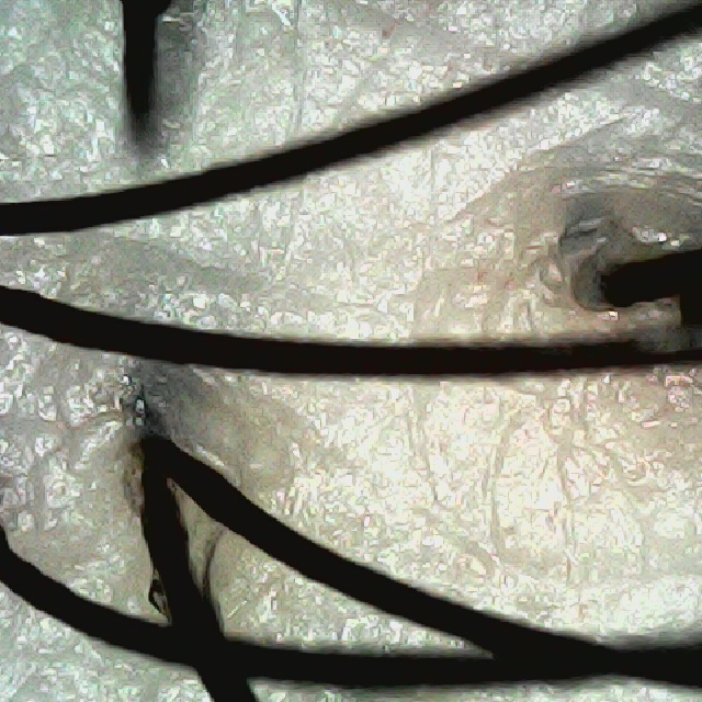 탈모 극복 프로젝트 - 뒷머리 두피 모습이다.