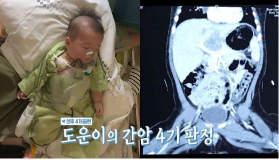 최필립 아들 소아암 4기