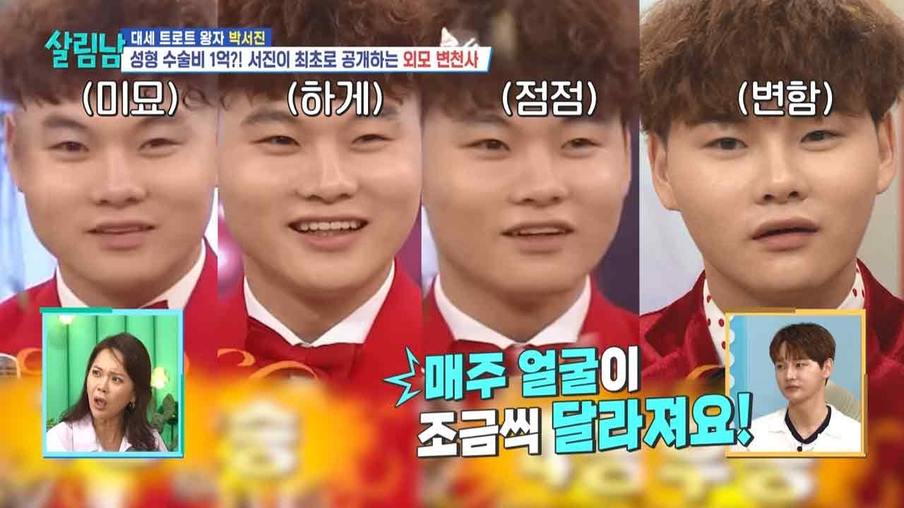 박서진 성형 변천사