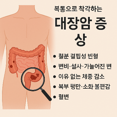 복통으로 착각하는 대장암 증상
