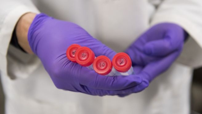 호중구 정상 수치