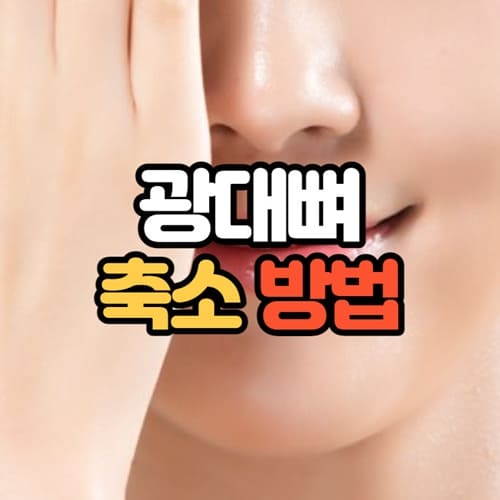 광대뼈 축소 방법