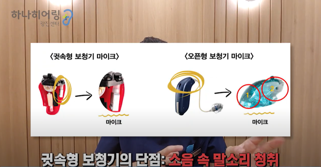 오픈형 보청기의 장점