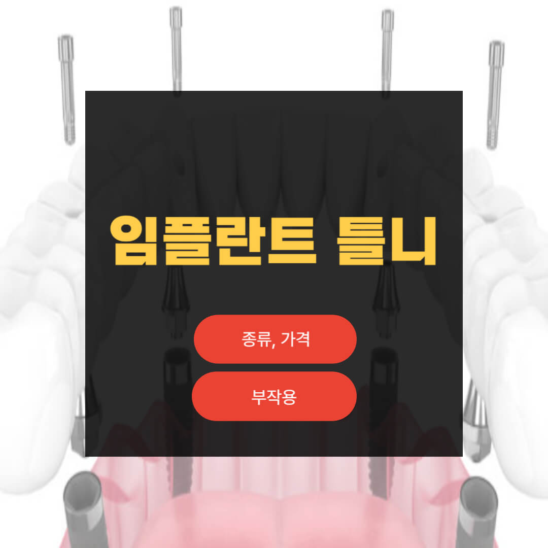 임플란트 틀니
