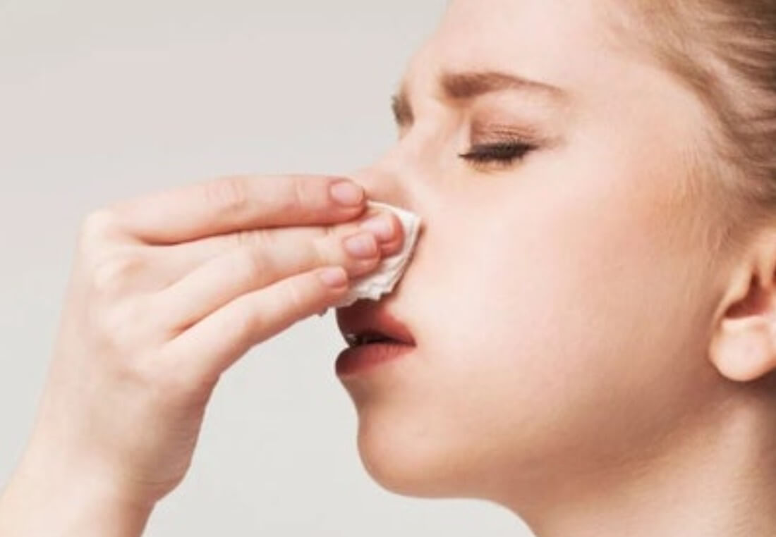 코피 흘리는 여성