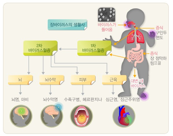 수족구를 일으키는 장바이러스