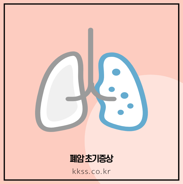 폐암 초기증상