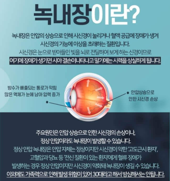 녹내장 증상