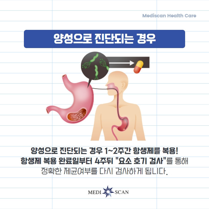 헬리코박터균- 위염- 위궤양- 소화불량 -위암1