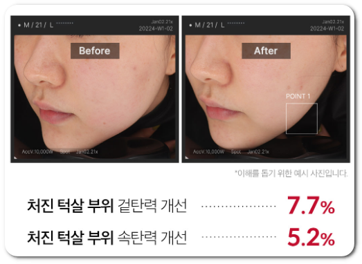 김희선 마사지기 효과