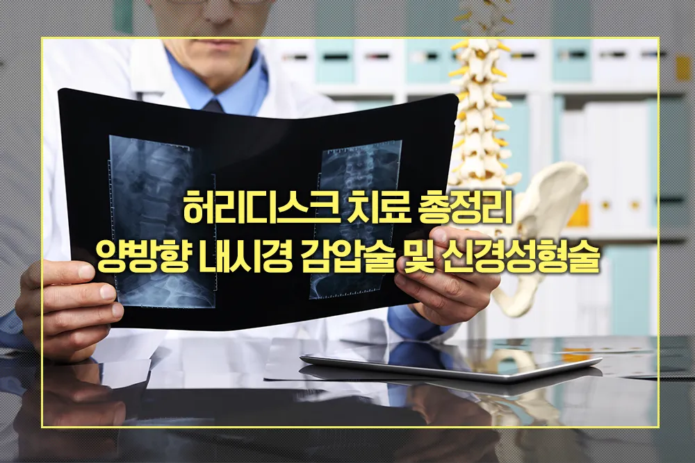 양방향 내시경 감압술 및 신경성형술 효과