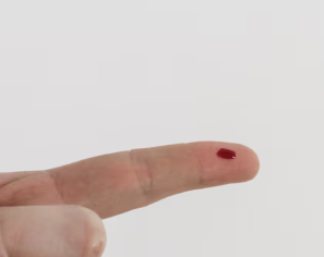 백혈병 초기증상 13