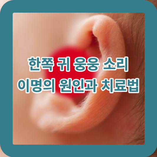 한쪽 귀 웅웅 소리, 이명의 원인과 치료법 썸네일