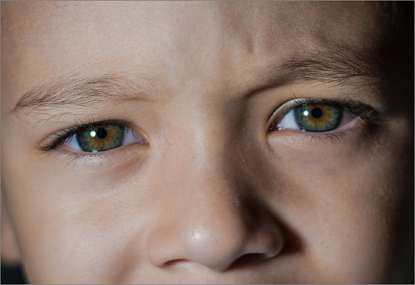 ADHD 증후군 증상