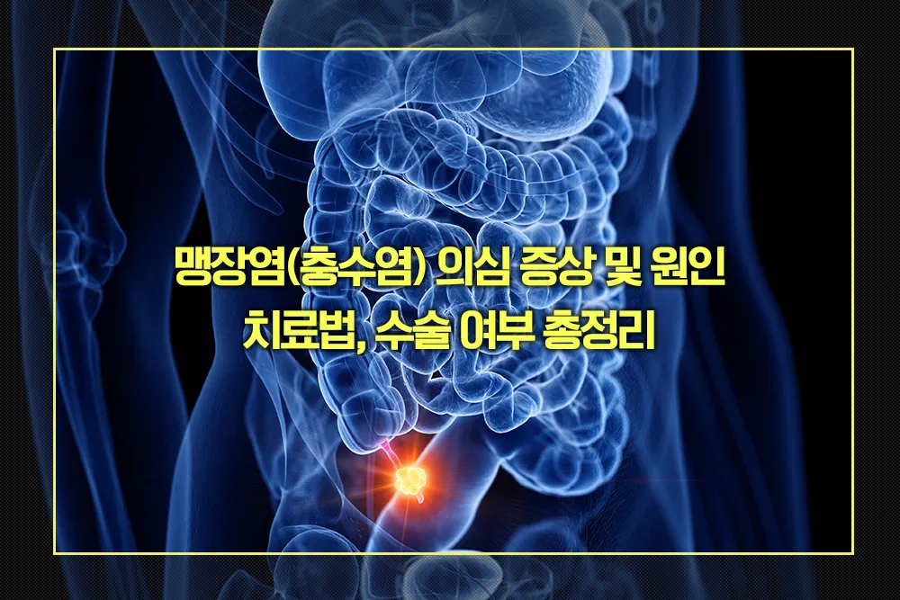 맹장염 충수염 의심 증상 및 원인