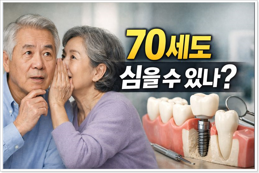 6070 임플란트 완전 가이드
