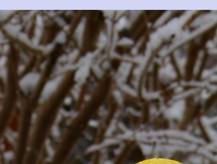 대상포진 초기증상