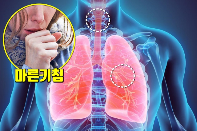 가습기 효능 마른기침 멈추는 방법, 건강 팁줌 매일꿀정보