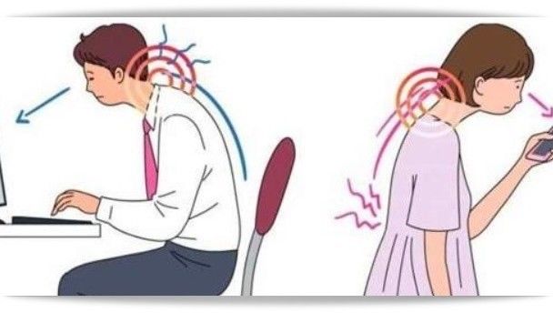 근막통증