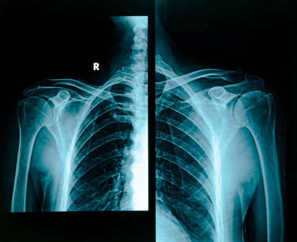 목에 가래낀 느낌 및 없애는 법&amp;#44; 가래감은 목구멍&amp;#44; 기관지 등 호흡기관에 분비물이나 염증이 쌓여 생기는 증상입니다. 이 증상은 다양한 원인에 의해 발생할 수 있으며 그에 따라 적절한 조치가 필요합니다. 가래의 주요 원인와 목에 가래낀 느낌 없애는 법을 참고하시기 바랍니다. 