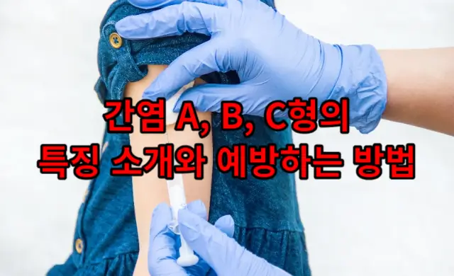 간염(Hepatitis): A&#44; B&#44; C형의 특징 소개와 예방하는 방법