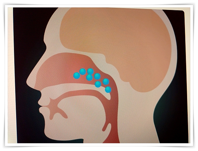 목에 가래낀 느낌 후비루