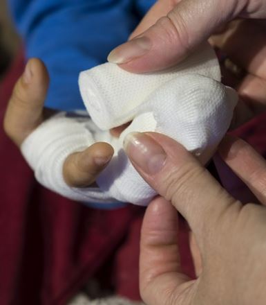 대상포진 초기증상