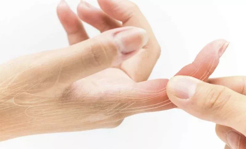 손가락 인대 늘어남