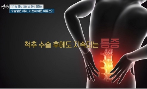 척추수술후통증