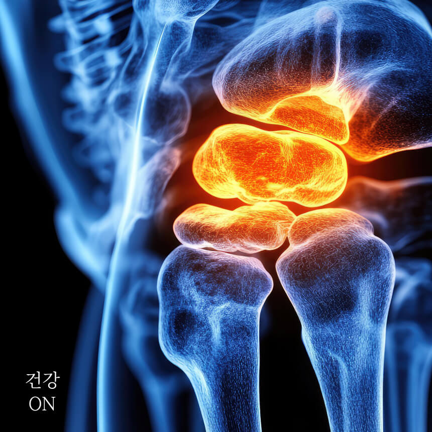 근골겨계 특수 시술 용어