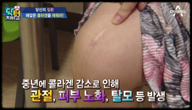 콜라겐과 치매: 두 가지의 숨겨진 연관성