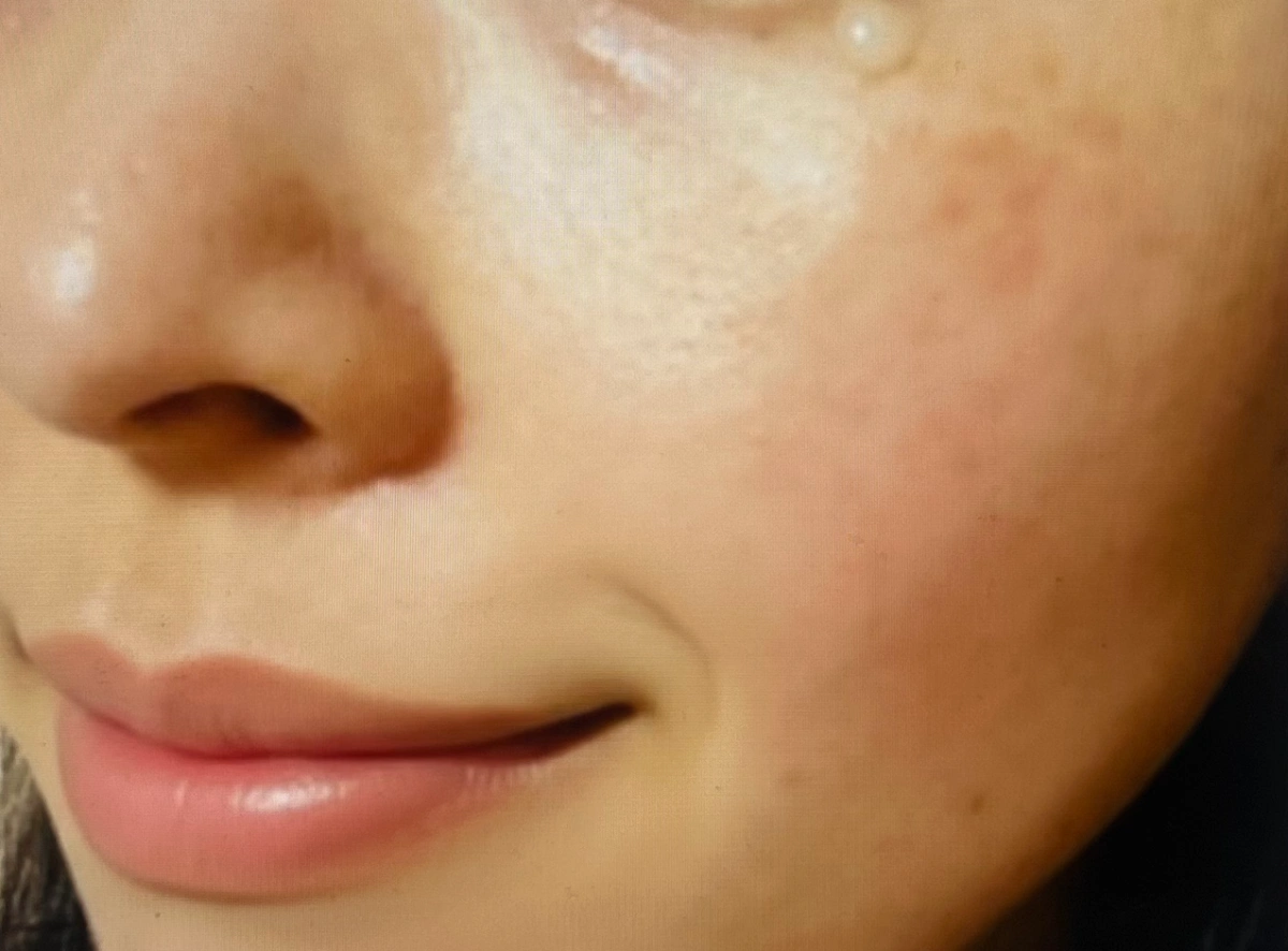 메라블 유쎄라블 리프팅 900샷 아이크림 내돈내산 후기 증명 사진