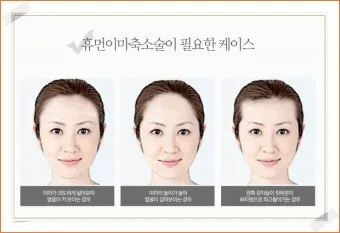 이마가 넓은 여자 관상 특징과 해석_21