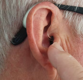 난청 치료법 진단기준 합병증