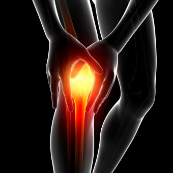 무릎관절염 