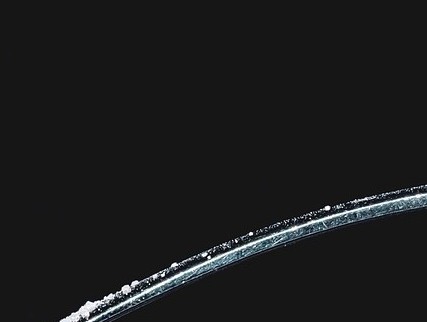 당뇨병 초기증상